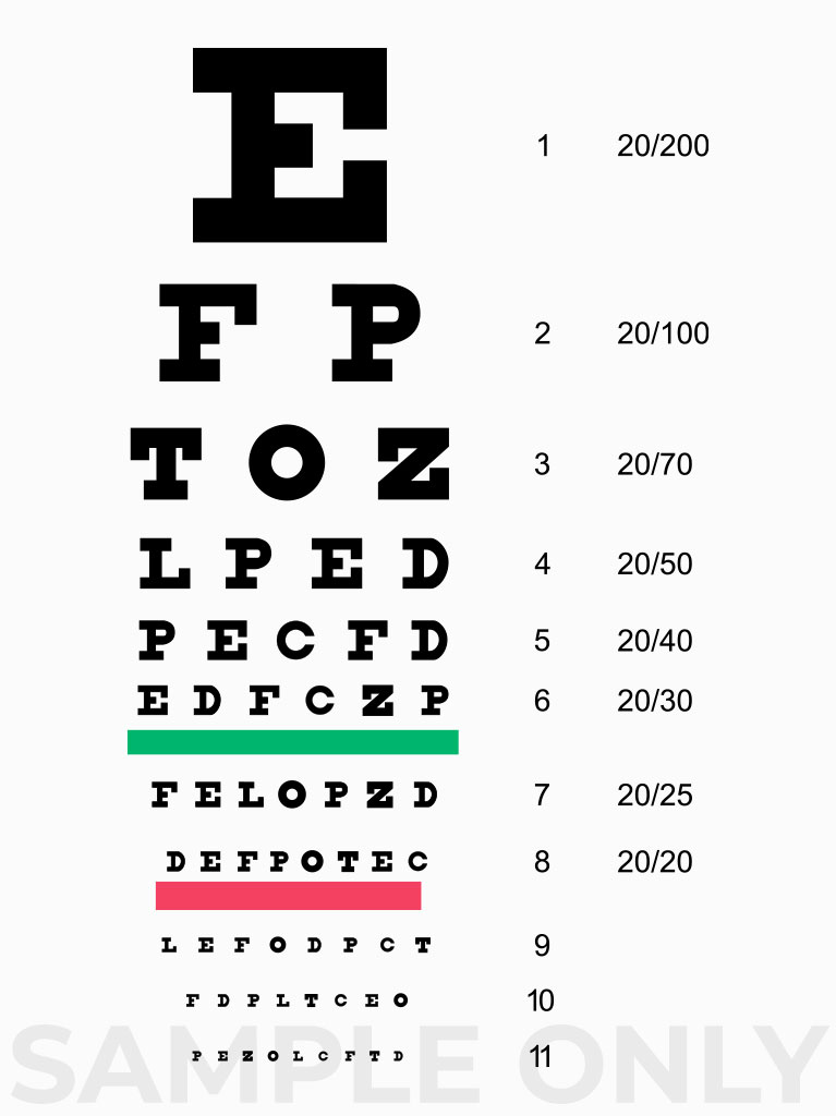 Visual Acuity Test